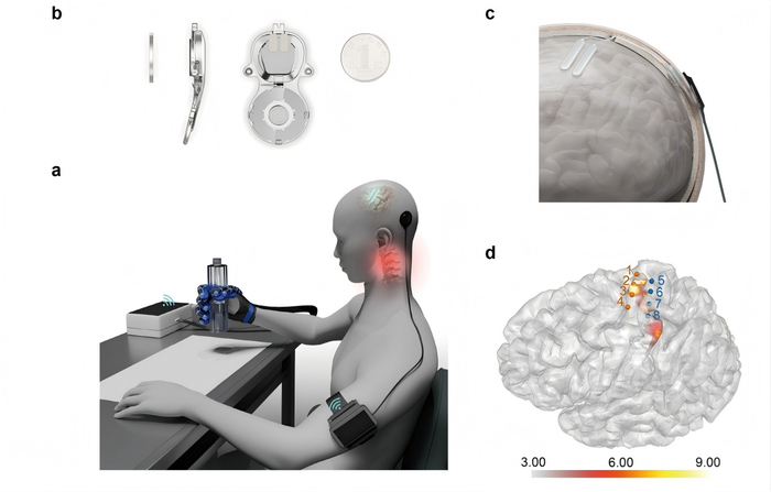 中国首款侵入式脑机接口医疗器械获批上市。